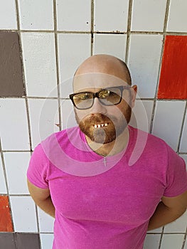 Bald man in eyeglasses with ugly teeth
