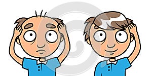 Bald man - hair loss treatment