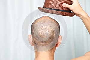 Bald man with a hat photo