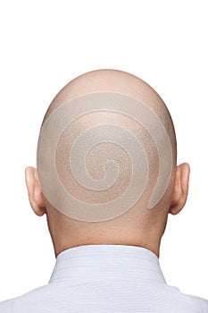 Bald man head