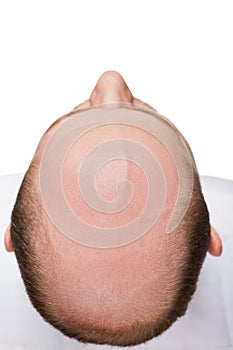 Bald man head