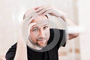 Bald man looking mirror at head baldness and hair loss