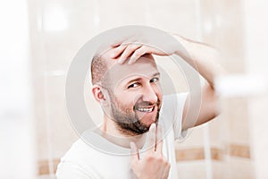 Bald man looking mirror at head baldness and hair loss