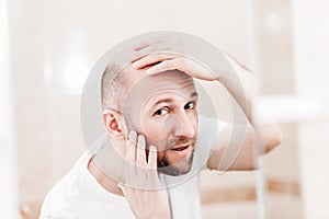Bald man looking mirror at head baldness and hair loss photo