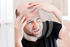 Bald man looking mirror at head baldness and hair loss photo