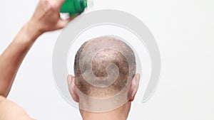 Bald man using hair restorer