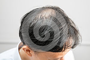 Bald in the middle head and begin no loss hair glabrous of mature Asian business smart active office man