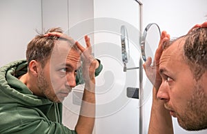 Balding middle age man looks in mirror and checks how much hair he lost