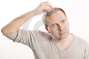 Baldness Alopecia man hair loss haircare