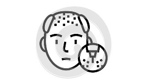 baldness disease line icon animation