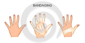 The bandages hands