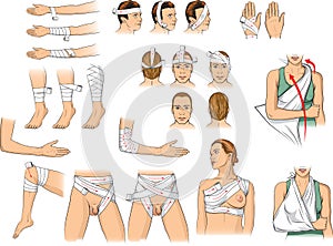 Bandaging techniques photo