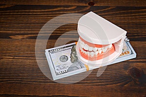 Banknotes in a pile, a model of teeth on top on wooden background. Dental costs concept