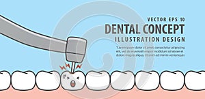 Banner Caries tooth with dental bur illustration vector on blue