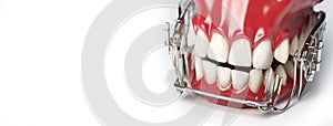 Banner metal braces on teeth in artificial jaw on white background. Concept of fear of dental treatment