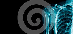 Banner x-ray shoulder