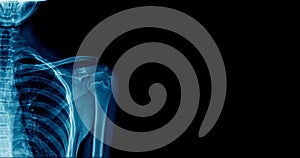 Banner shoulder x-ray img