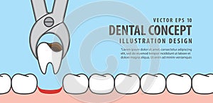 Banner Tooth removal illustration vector on blue background. Den