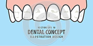 Banner Upper White spots on teeth illustration vector on blue ba