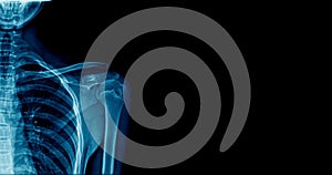 Banner x-ray shoulder