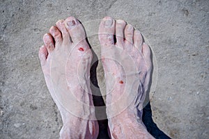 Bare feet of men in the pink salt lake. Salt Deposit. Treatment of wounds with salt.