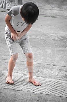 Bare Foot Bleeding after Injury on a Boy