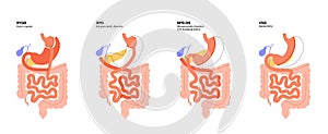 Bariatric surgery poster