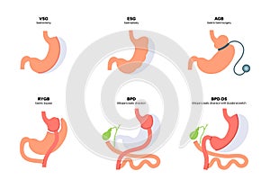 Bariatric surgery poster