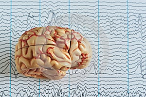 Barin model on background of brain waves