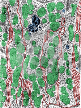 Basal infoldings. TEM