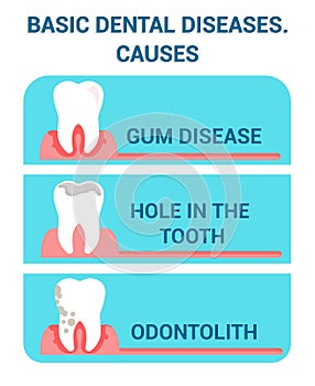 Basic Dental Diseases, Problems Flat Vector Poster