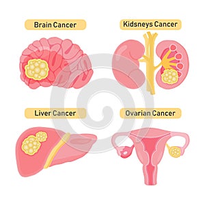 Cancer types flat  illustration.