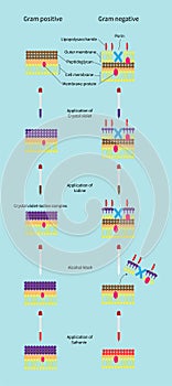 The different between bacteria gram positive and gram negative