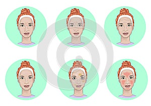 Illustration of the Common face skin problems