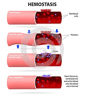 Basic steps in hemostasis photo