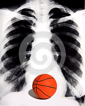 Basketball Fan