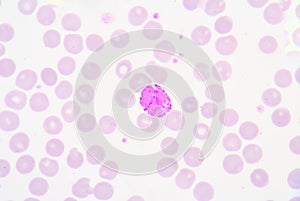 Basophil granulocyte photo