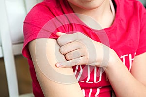 BCG is vaccination on female shoulder, close up view photo