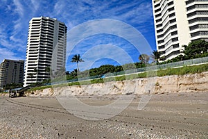 Beach Erosion in South Florida