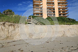 Beach Erosion in South Florida