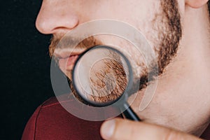 Beard under a magnifying glass. hairline on a man`s face close up. portrait of a guy with a mustache