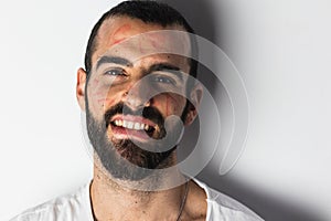 Bearded man with traces of lipstick on his face