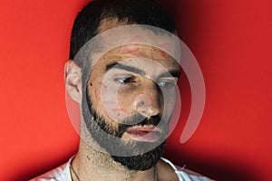 Bearded man with traces of lipstick on his face