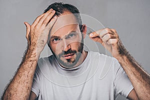 bearded middle aged man holding fallen hair and looking at camera