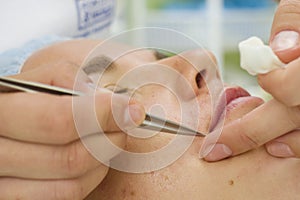 Beautician depilating a woman with tweezers