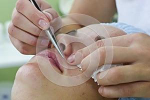Beautician depilating a woman with tweezers