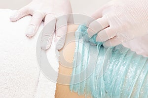 Beautician depilating young womans legs with liquid sugar in spa center.