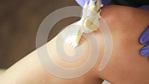 Beautician hands in a blue rubber glove remov unwanted leg hair with shugaring.