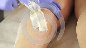 Beautician hands in a blue rubber glove remov unwanted leg hair with shugaring.