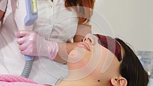 Beautician makes laser hair removal on facial skin above lips. removing unwanted body hair. Beauty procedure. Laser